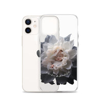 Baby in a Flower 'Life Can Be Beautiful' Clear Case for iPhone®