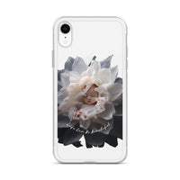 Baby in a Flower 'Life Can Be Beautiful' Clear Case for iPhone®