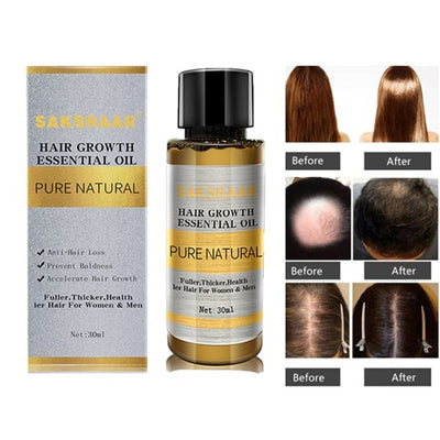 Hair Growth Essential Liquid Serum Natural Ingredients, Works in 30 Days